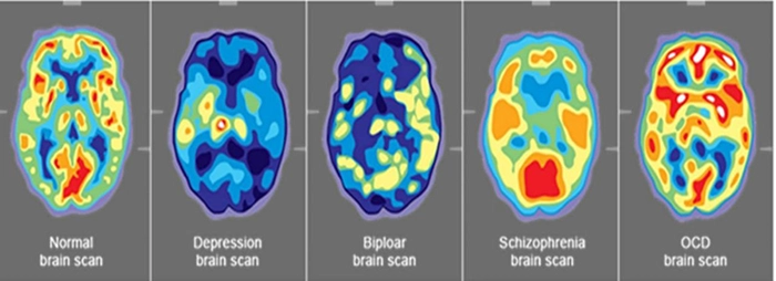 تصویر fMRI